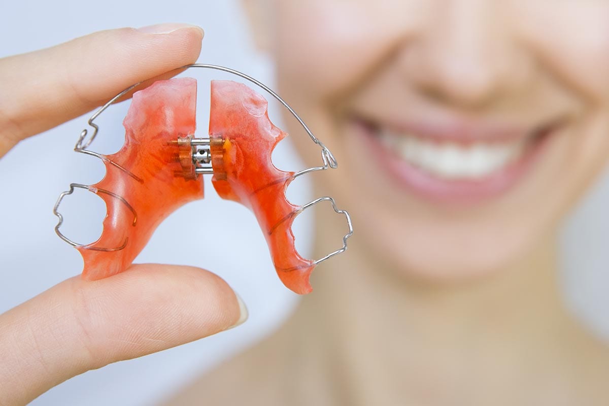 Retainers After Orthodontic Treatment